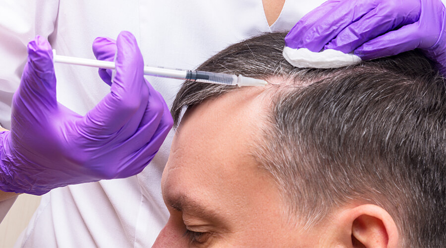 raised acne scar treatment